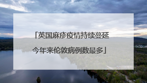 英国麻疹疫情持续蔓延 今年来伦敦病例数最多